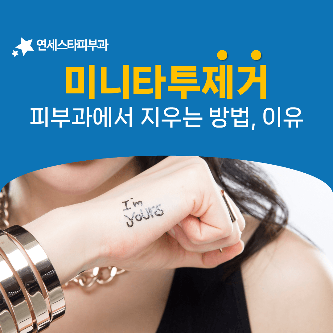 작다고 쉬운 것은 아닌 미니 타투의 제거 조건
