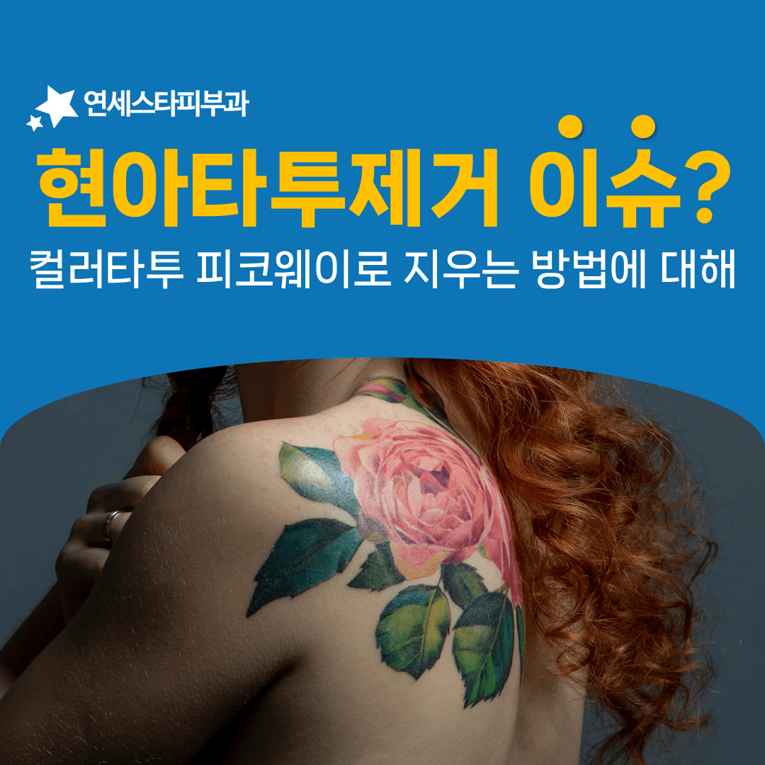 빨강과 파랑과 검정에 각각 다른 빛을 쓰는 컬러 타투 제거