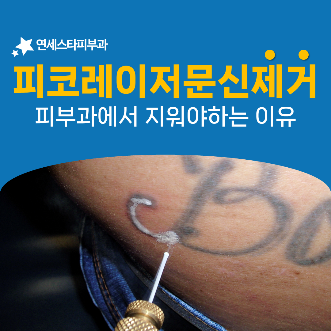 피코 레이저는 뷰티 장비가 아니라 의료기기입니다