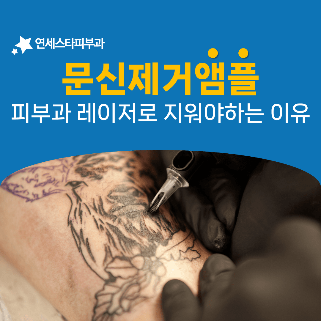 문신제거 앰플로는 닿지 않는 피부 층