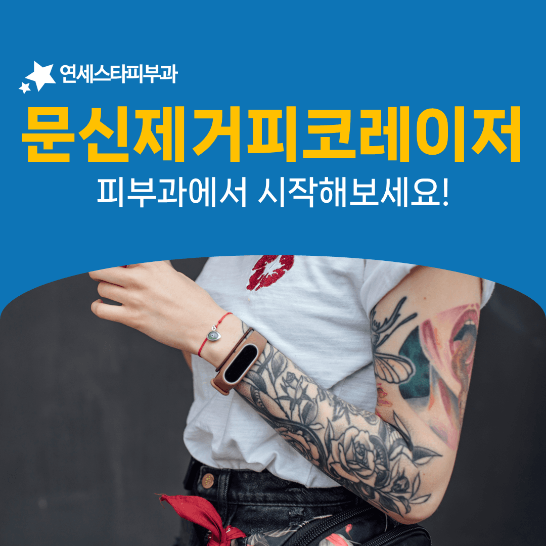 예전에 포기했던 문신제거를 다시 꺼내는 시점