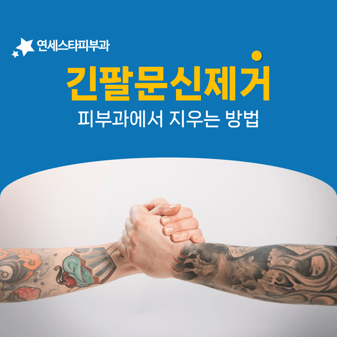 팔 전체 문신을 나눠서 지우는 계획