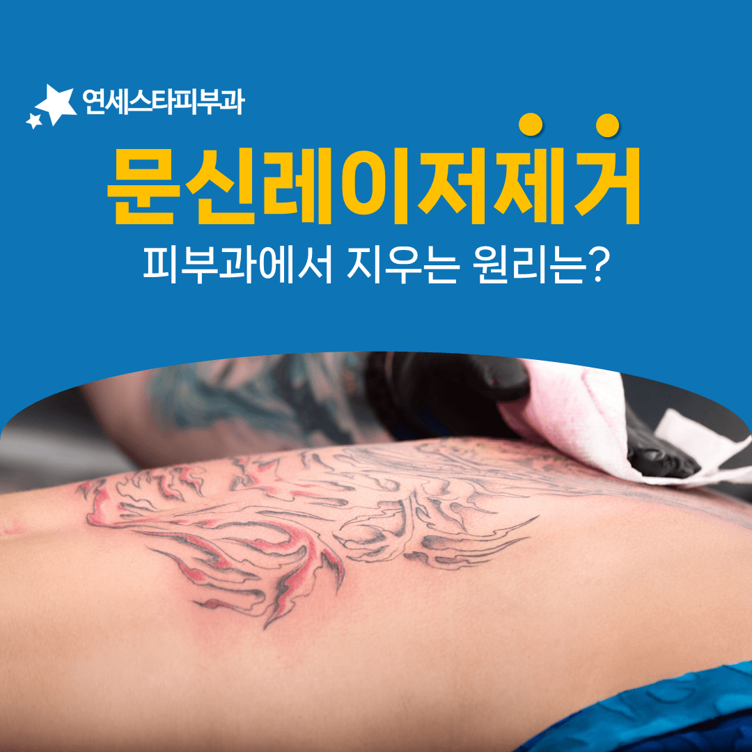 색소마다 다른 빛을 흡수한다는 원리