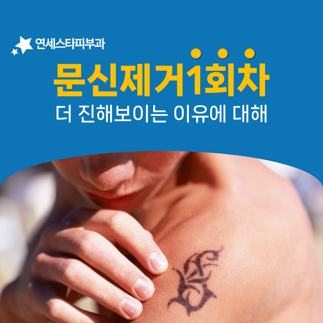 문신제거 1회차 뒤 색이 더 진해 보일 때