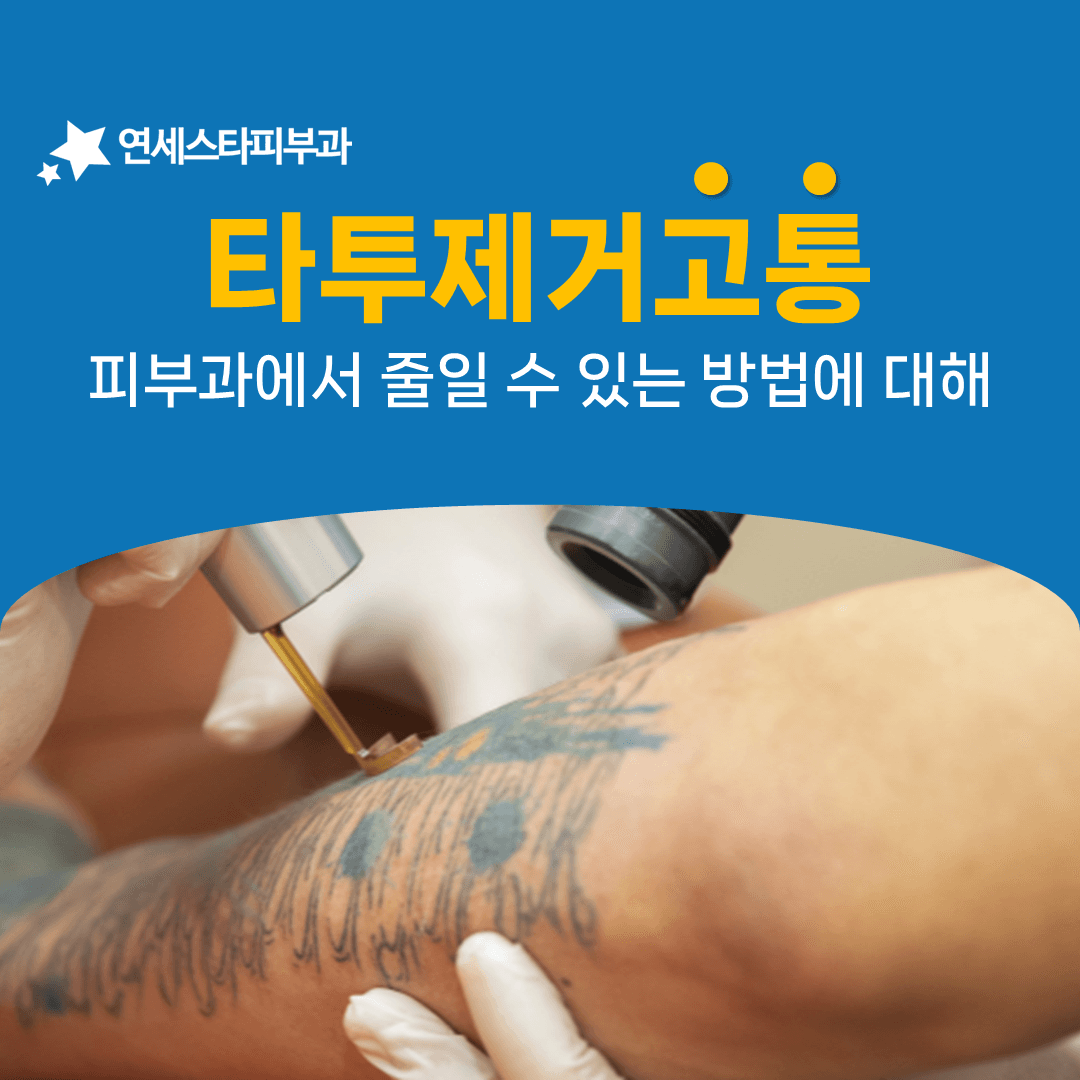 타투제거 통증을 낮추는 네 가지 마취 방법
