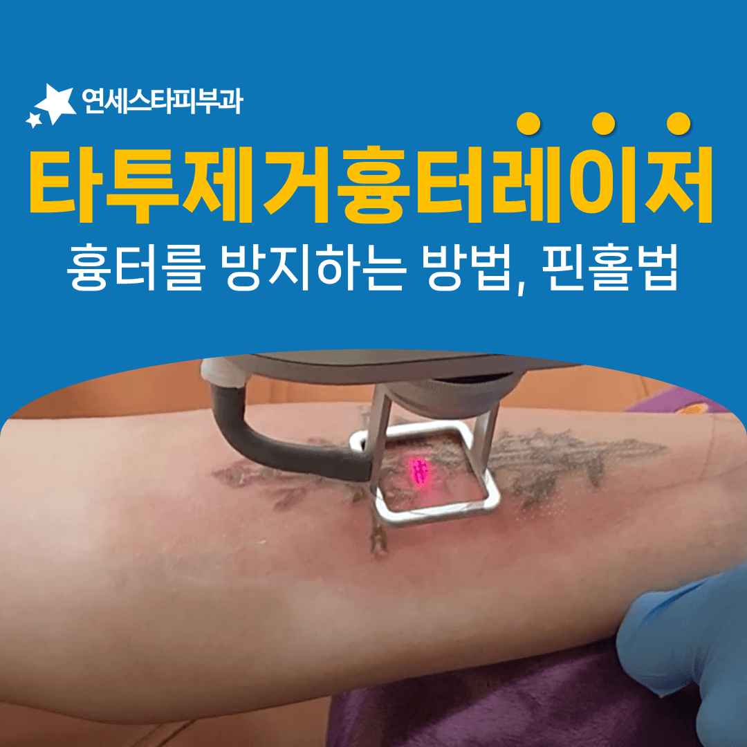 핀홀법이 흉터 치료에서 문신제거로 넘어온 이유