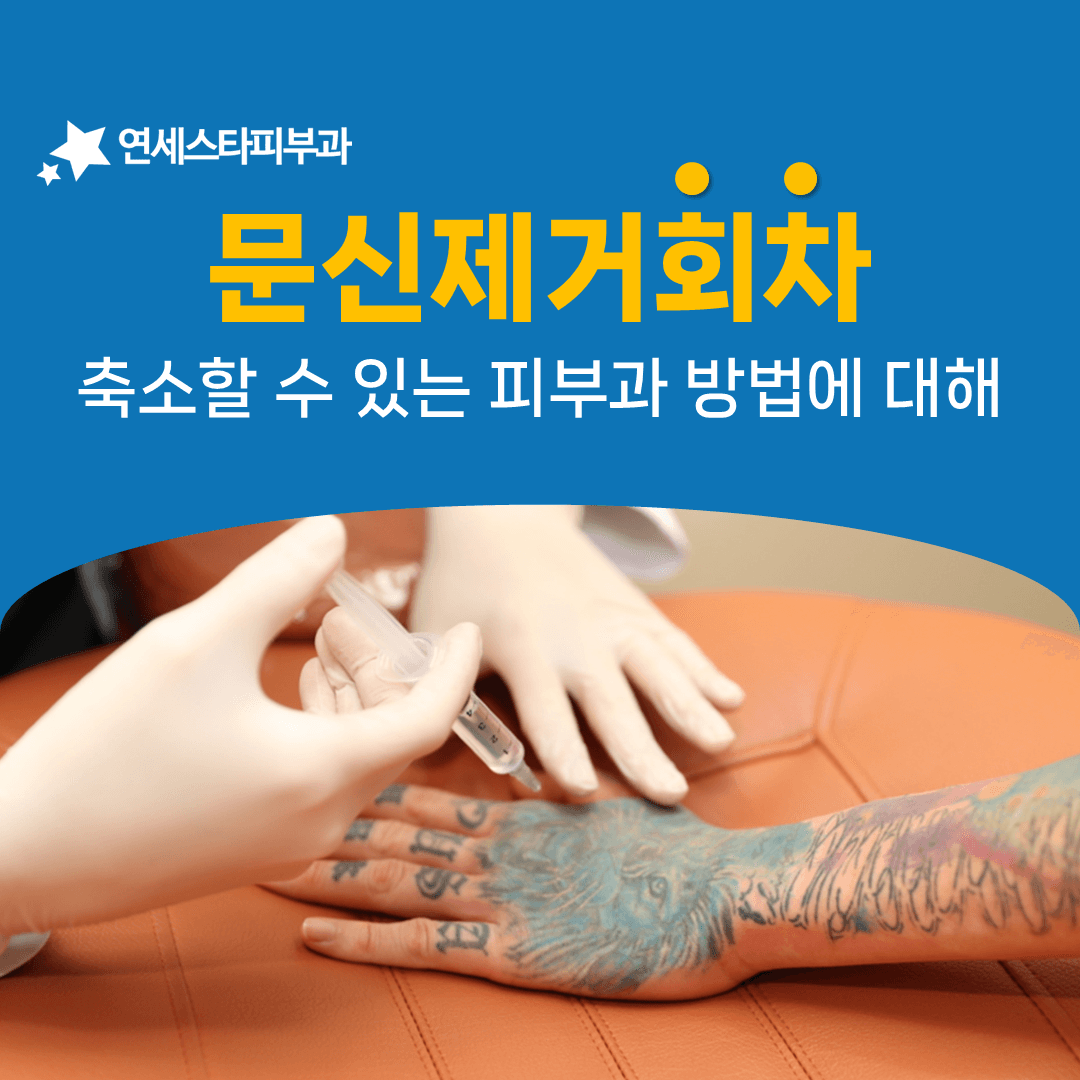 문신제거 회차를 줄이는 R제로 방식의 원리
