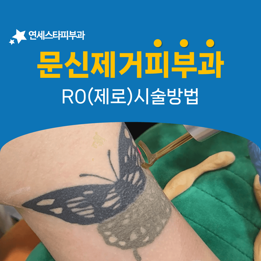 R제로 시술이 한 자리에서 진행되는 순서
