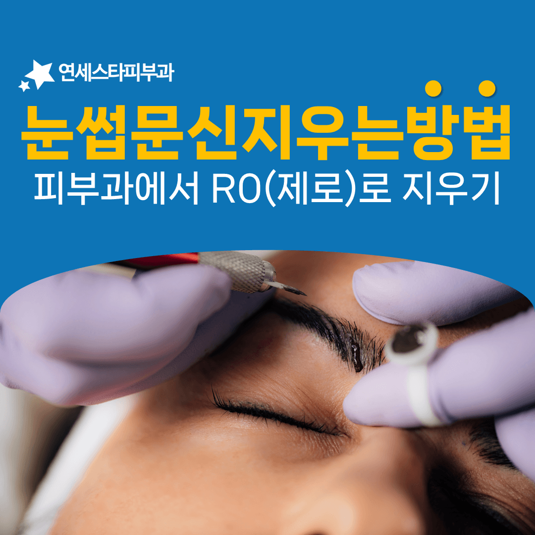 눈썹 문신을 R제로로 지울 때 달라지는 간격