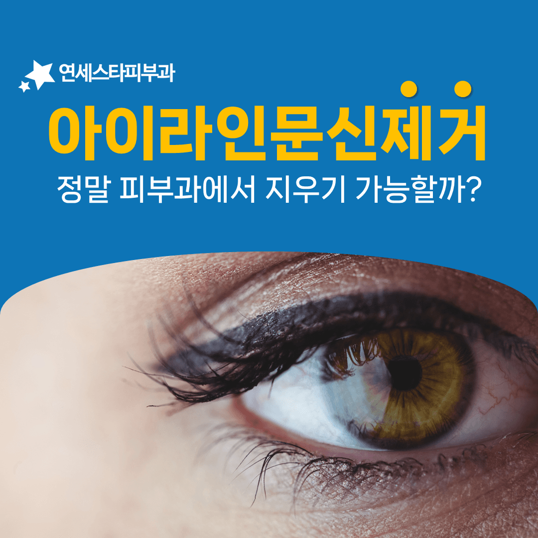 아이라인 문신제거에서 눈을 보호하는 방법