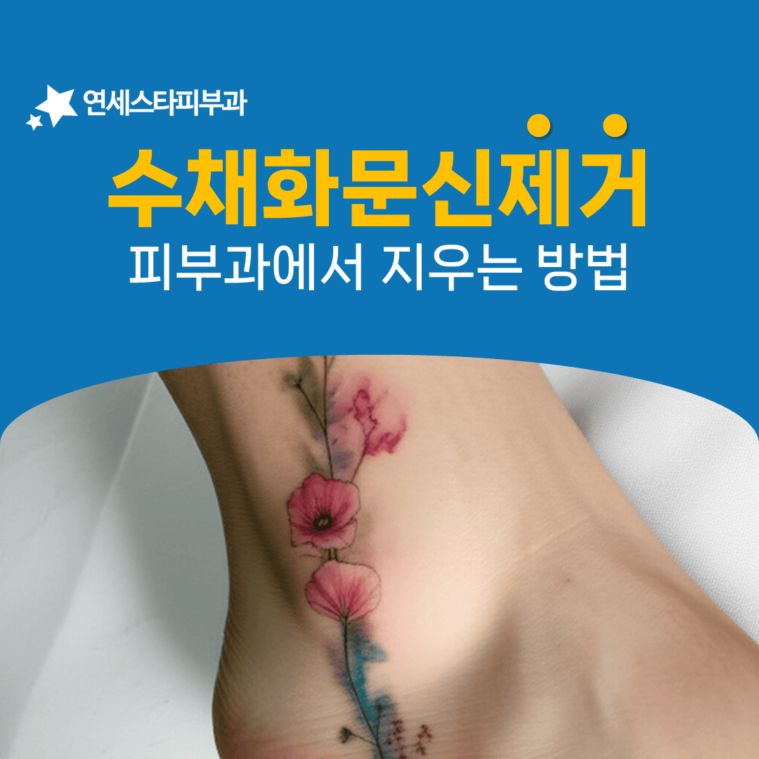경계가 없는 수채화 타투를 고르게 지워 나가는 법