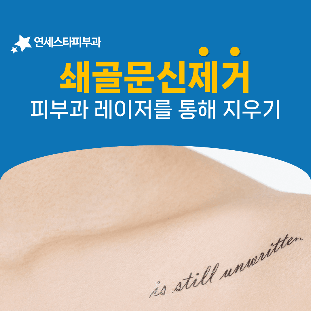 쇄골 문신이 옅어지기까지 걸리는 회차와 간격