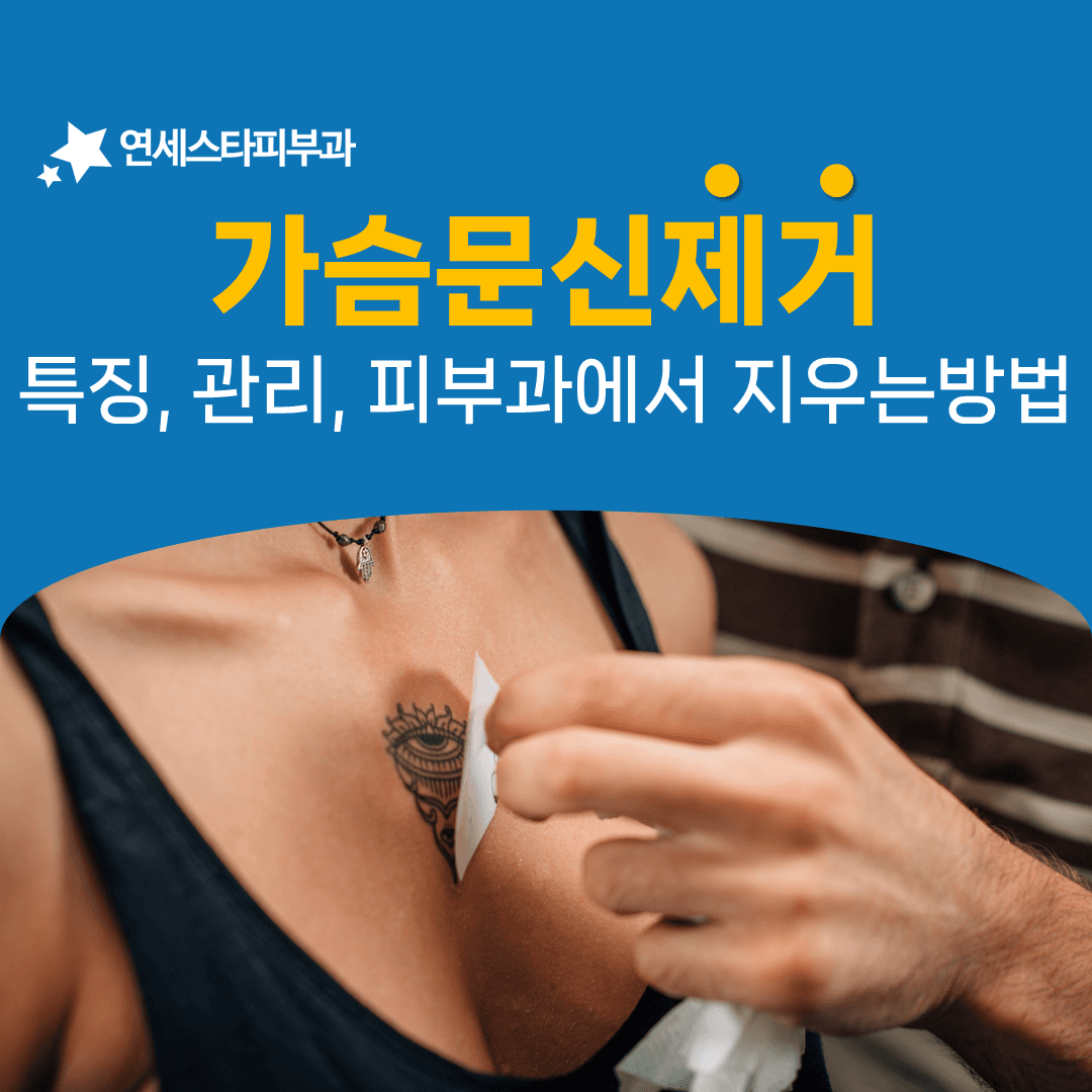 가슴 문신 제거는 자극을 줄이는 데서 시작합니다
