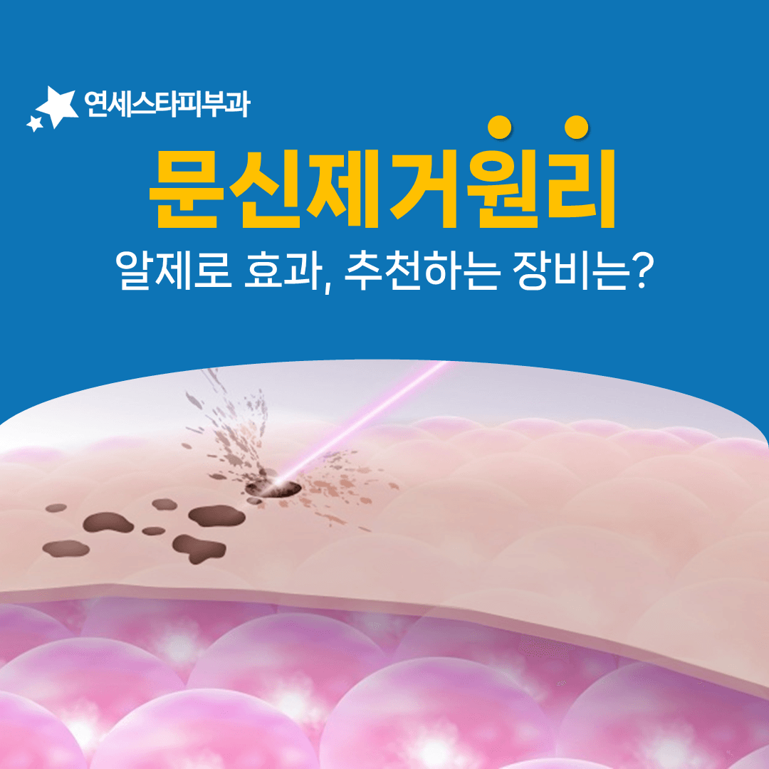 레이저는 잉크를 지우는 게 아니라 부숩니다