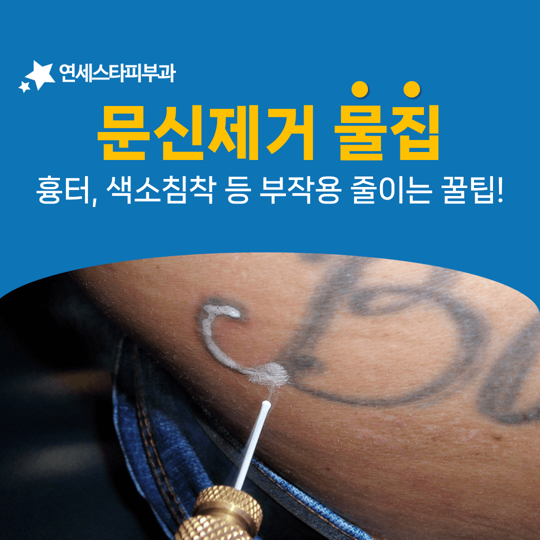 문신제거 중 물집을 줄이는 시술 전후 점검