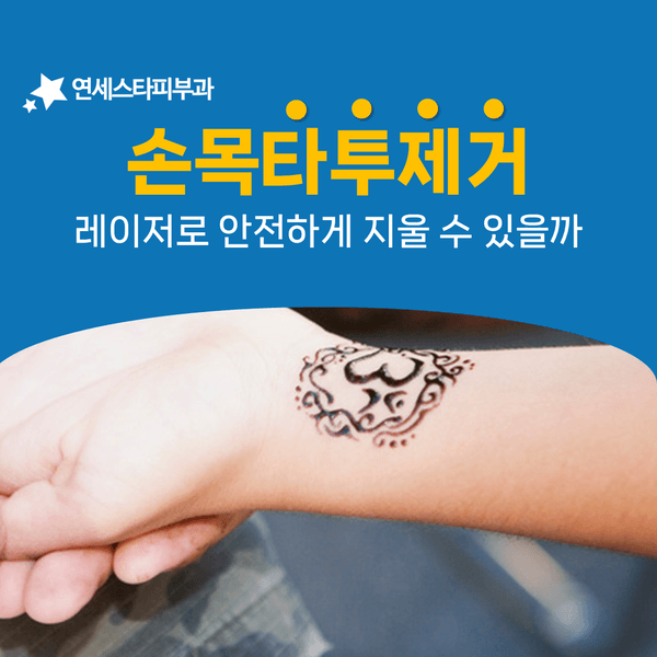 손목 타투 제거 기간을 좌우하는 것들