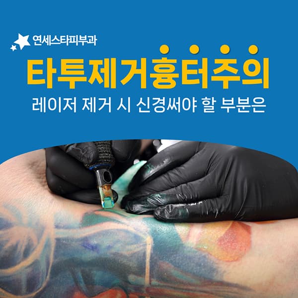 타투를 지운 자리에 흉터를 남기지 않으려면