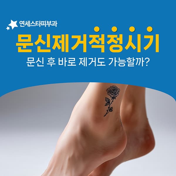 문신제거는 미룰수록 시간이 더 걸립니다
