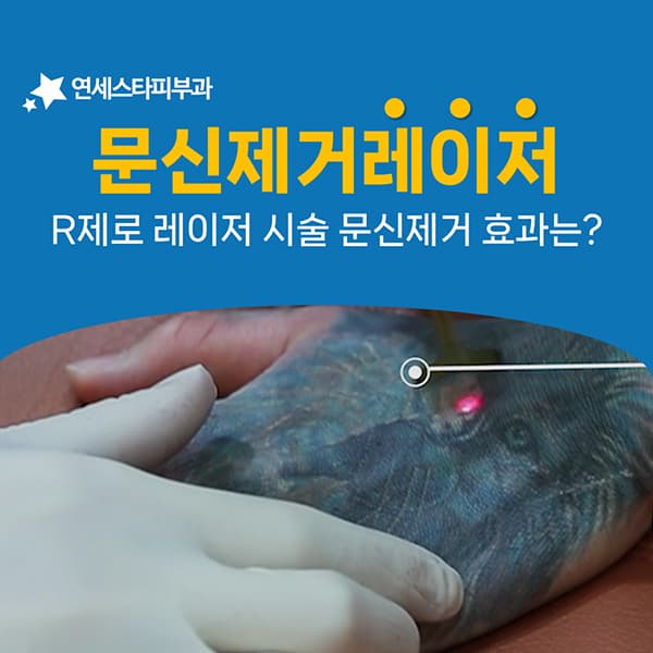 버블을 걷어내고 핀홀로 마무리하는 R제로 방식