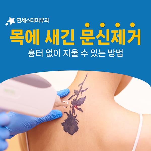 목 문신은 초반에 잘 빠지다 후반에 더뎌집니다