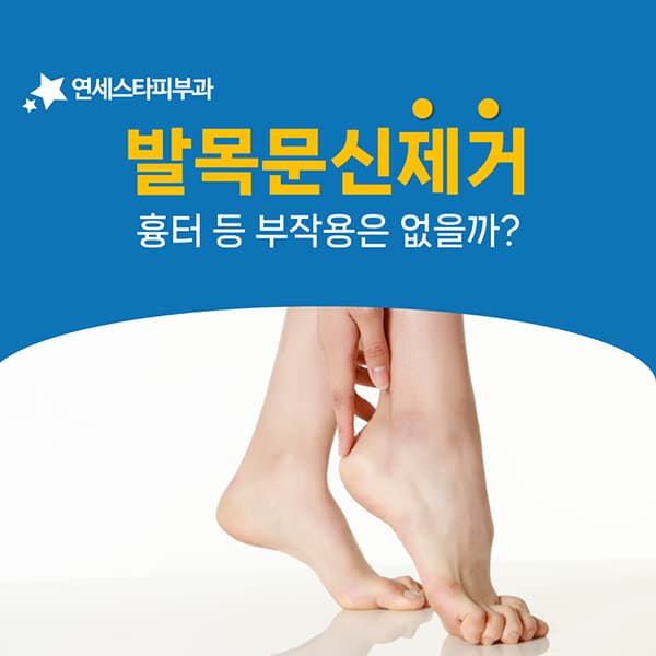 작은 발목 타투인데 제거 기간이 길어지는 조건