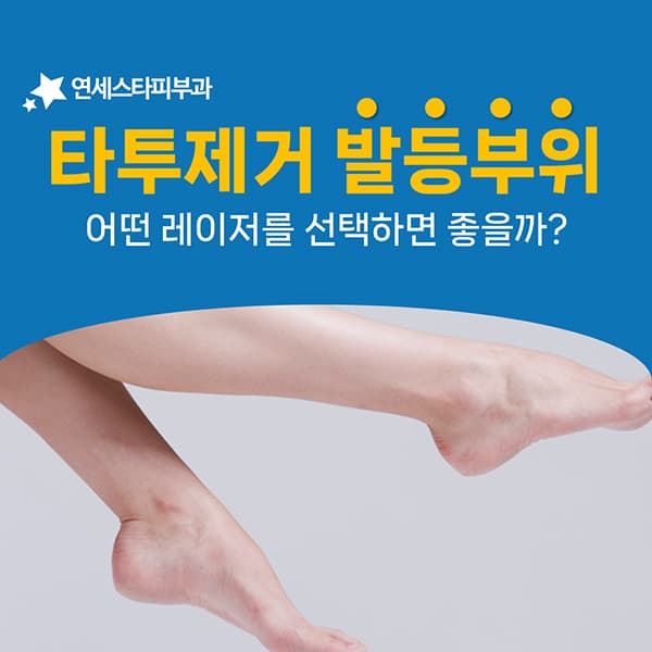 지방이 적고 신경이 많은 발등에서 레이저를 고르는 기준