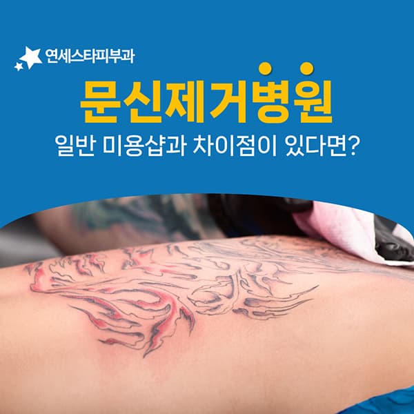 문신제거를 병원에서 받을 때 달라지는 대응의 폭