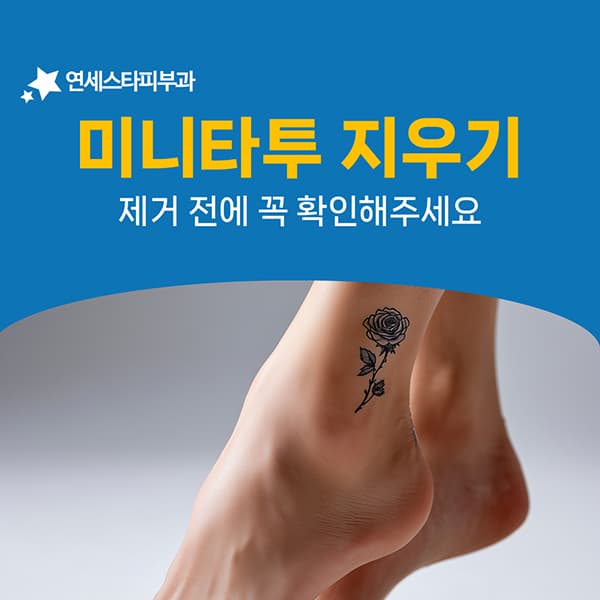 손목과 발목의 작은 타투가 오히려 지우기 까다로운 이유