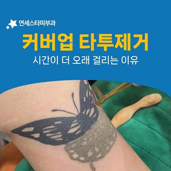 커버업 타투를 지울 때 작업이 두 배가 되는 사정