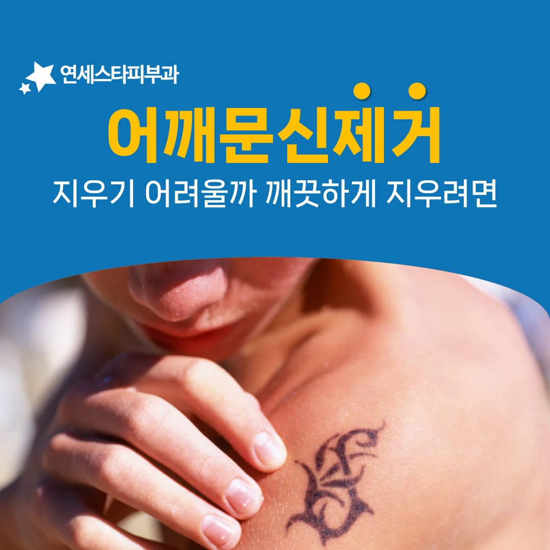 어깨 문신은 노출이 시작되기 전에 일정을 잡습니다