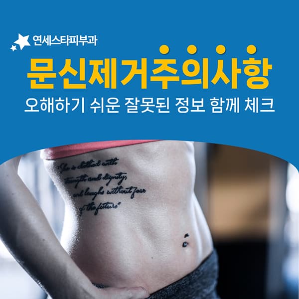 문신제거를 두고 자주 오가는 네 가지 이야기