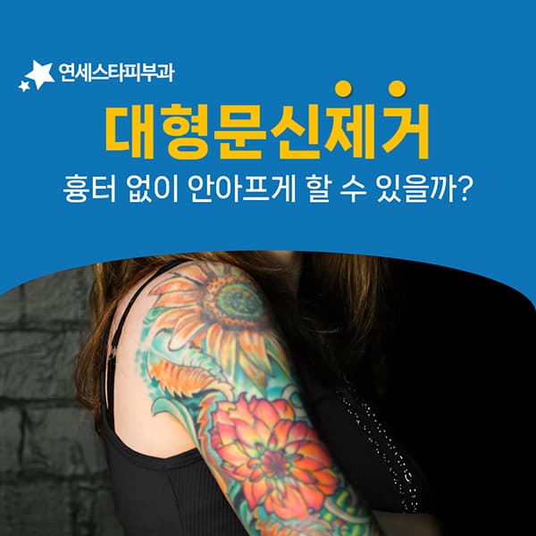 넓은 면적의 문신이 제거 난이도를 높이는 구조