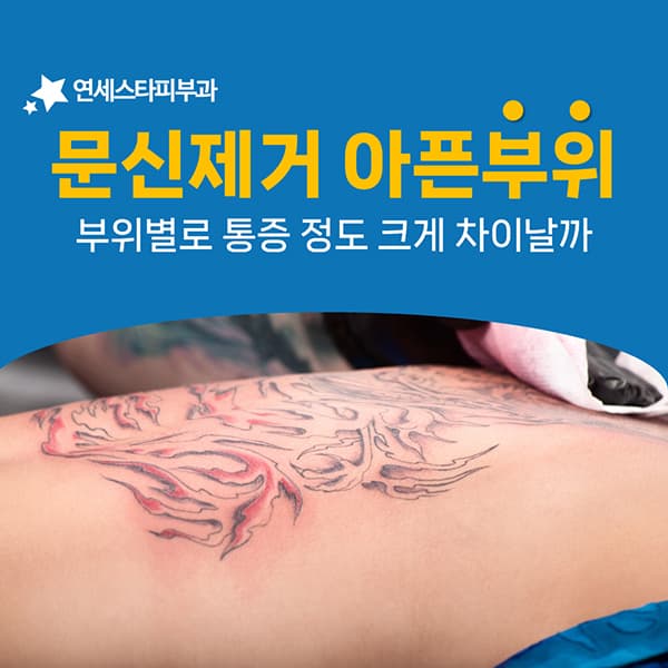 같은 출력인데 부위마다 아픔이 다른 세 가지 조건