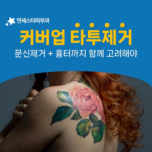 흉터를 덮은 커버업 타투가 나중에 남기는 숙제