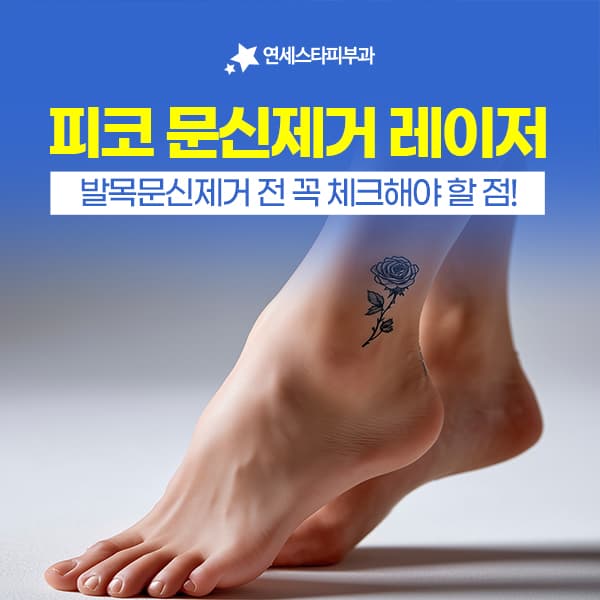 발목 타투 제거가 다른 부위와 달라지는 조건