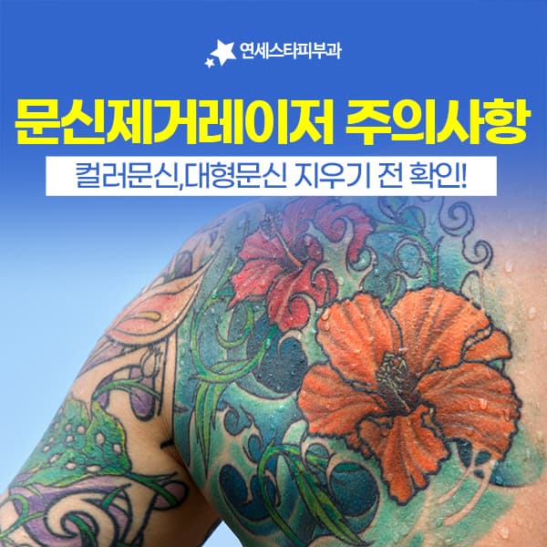 레이저를 자주 쏜다고 문신이 빨리 지워지지는 않습니다