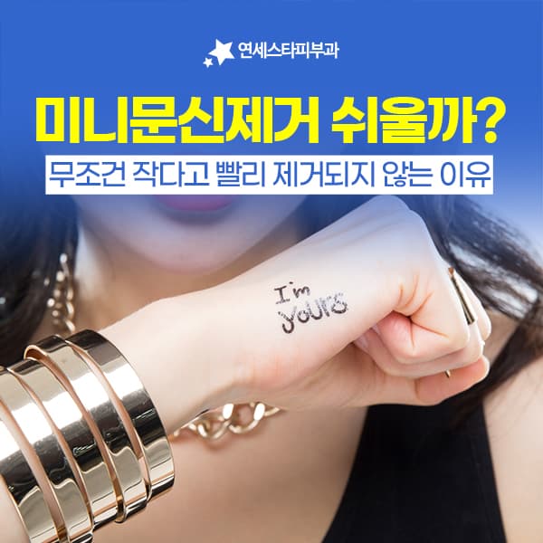 미니 타투를 지우는 횟수는 크기가 아니라 잉크 밀도가 정합니다