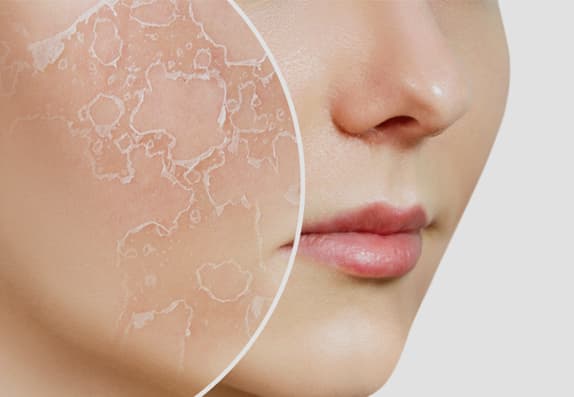 Skin Care & Acne