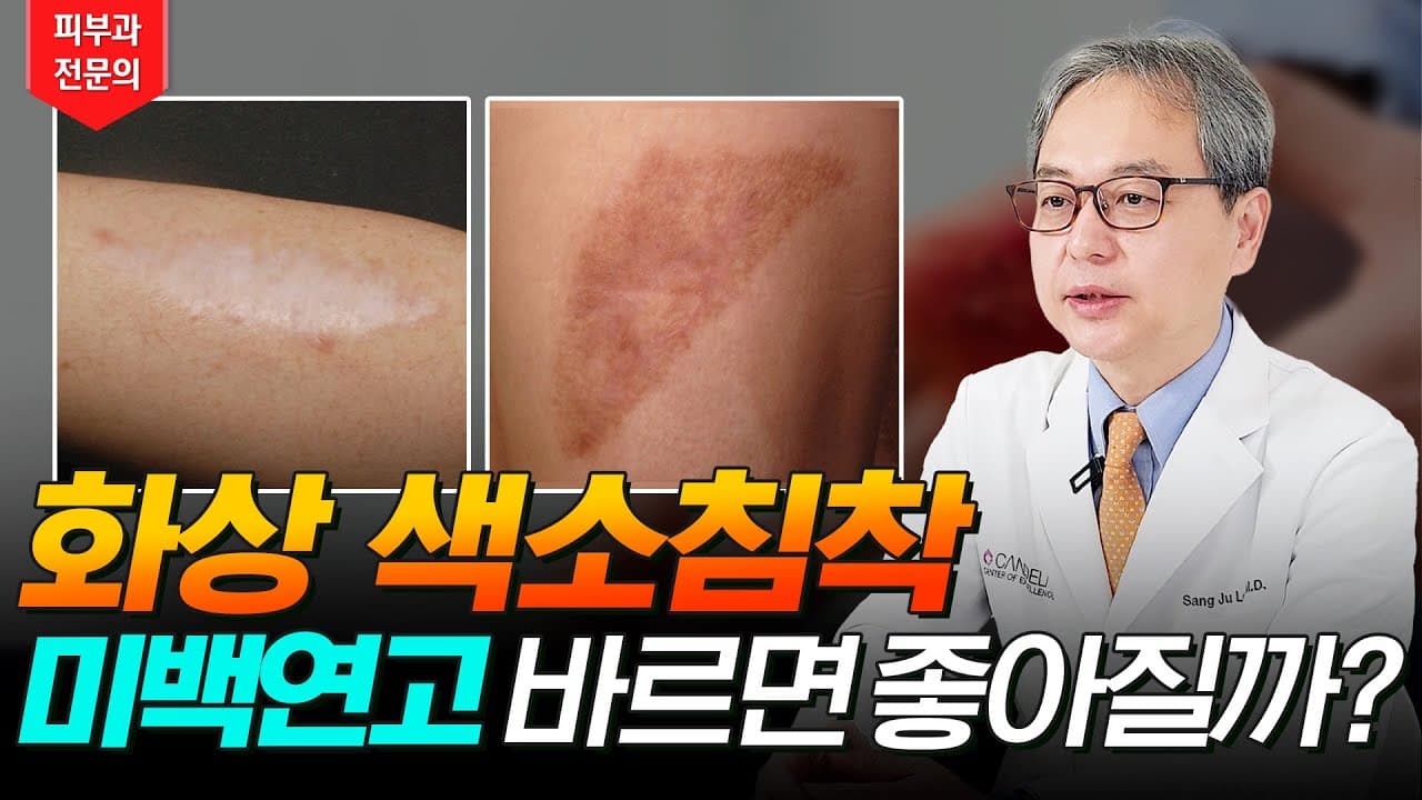 日常烫伤色素沉着,涂美白软膏会改善吗?