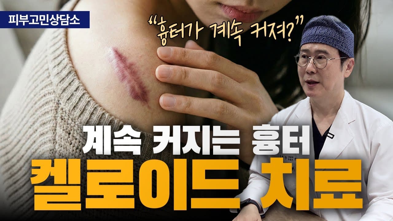 켈로이드는 불치가 아니라고, 20년 진료로 말씀드립니다 | 신촌 연세스타피부과