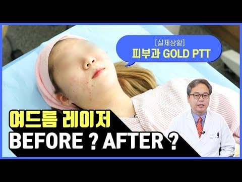 요즘 뜨는 여드름 치료 - 골드 PTT 치료 효과는?