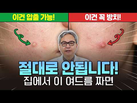 짜면 무조건 망합니다! 피부과 전문의가 절대 손대지 말라는 여드름 3가지