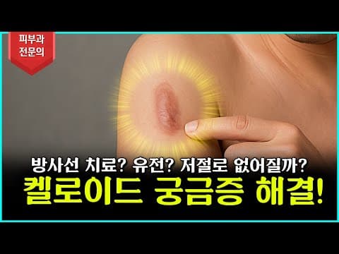 켈로이드 흉터를 지우기 위해 방사선치료가 필요할까? 아니면 그냥 둬야할까! 정확한 이야기 지금 시작합니다