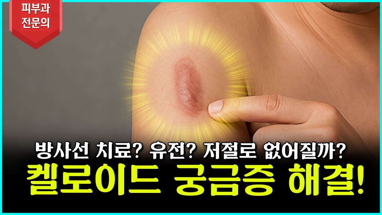 Radiation Therapy for Keloid Scars: Necessary or Leave Alone? The Facts