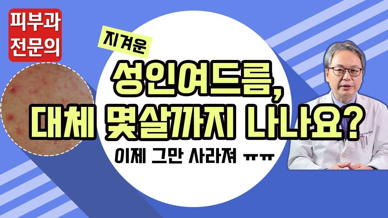 성인여드름, 나아질 수 있을까? (여드름없애는법)