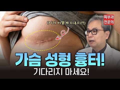 성형 후 흉터 생길까 봐 6개월 동안 무작정 기다리면 후회하는 이유 (전문의 팩트체크)