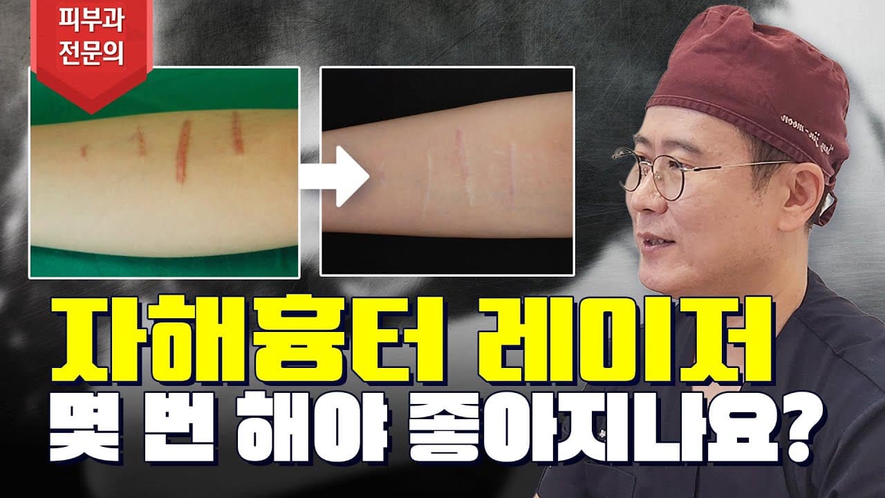 Self-Harm Scar Removal Laser Sessions And Real Results