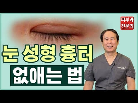 예뻐지려 쌍수 한 건데 흉터가 생겼다?;; | 눈성형 | 쌍수흉터 레이저