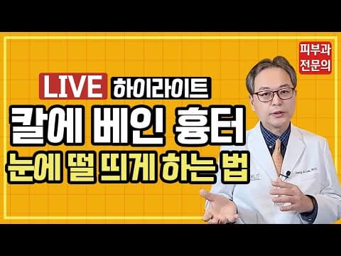 칼에 베인 흉터 최대한 눈에 덜 띄게 하는 방법?! (자해흉터없애는법)