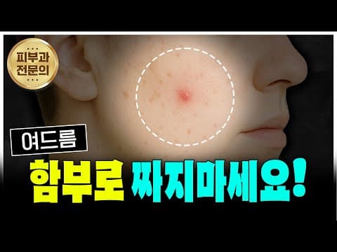 여드름, 오늘도 짰다간 후회할지도!!